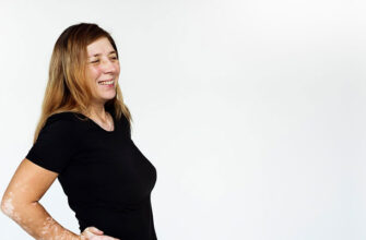 Как лечить витилиго? Причины и симптомы появления